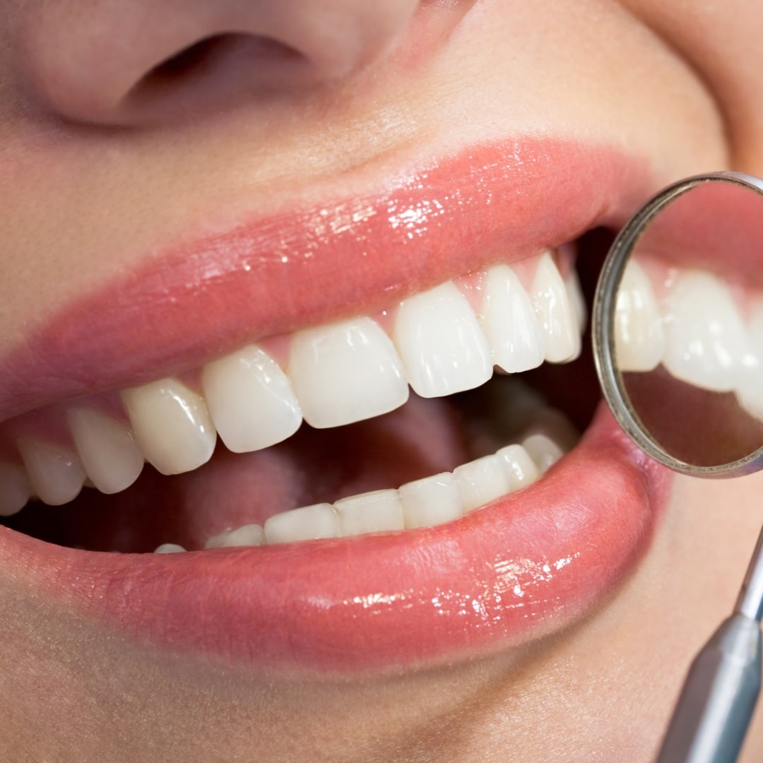 Pearl Smile Prestbury | Finance Options